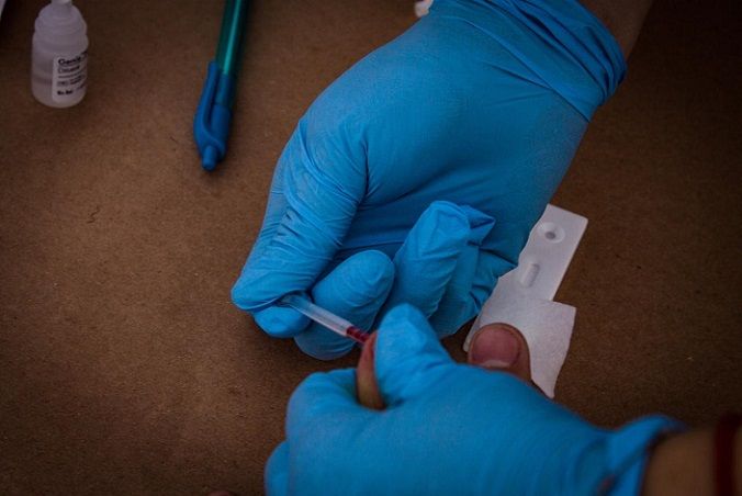 Nuestros afiliados pueden acudir a su unidad de salud o ferias de servicios en las que participa Servicios de Salud de Morelos para solicitar la prueba rápida de VIH; dependiendo el resultado, como una segunda etapa se les solicitará la prueba de ELISA para confirmar el diagnóstico, la cual no tiene ningún costo, lo mismo que el tratamiento antirretroviral