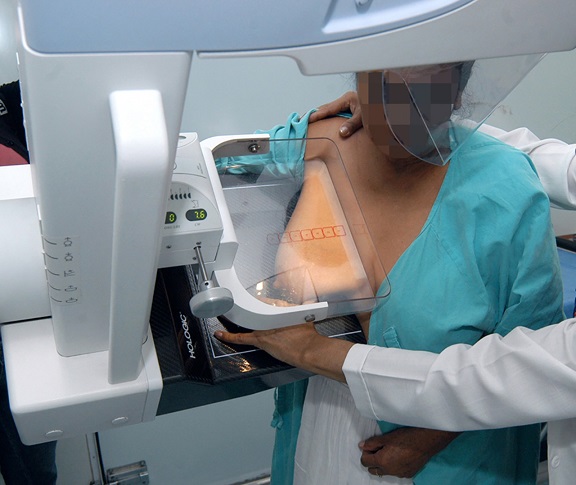 Refirió que, de acuerdo con datos del Informe Financiero y Actuarial, en 2019, el cáncer fue la segunda causa de morbilidad general en el ISSSTE, superada sólo por las enfermedades cardiovasculares; ambas patologías generaron un gasto de 12 mil 745 millones de pesos, (44.8 por ciento del gasto de funcionamiento del seguro de salud)